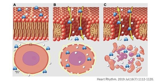 パルスフィールド原理